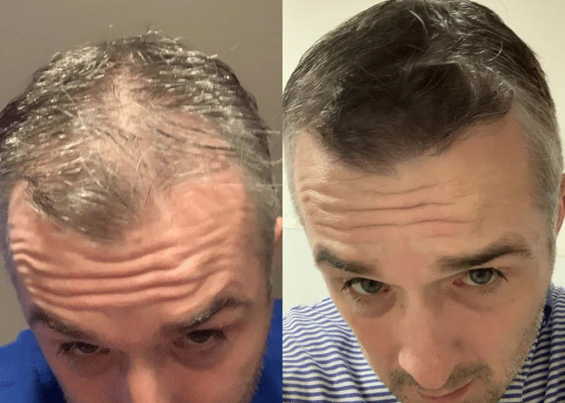 Résultat Avant/Après